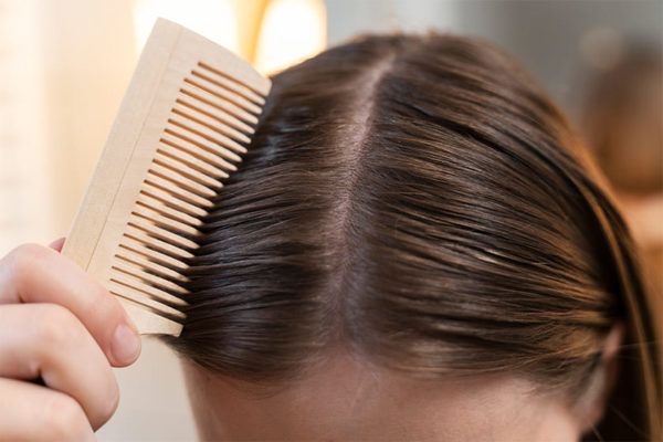 Greasy Hair: Causes, Treatments, and Home Remedies