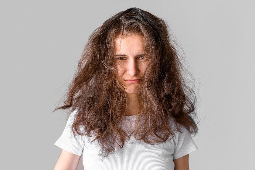 How to Avoid Dry and Itchy Scalp during Winter Season 1 itchy scalp